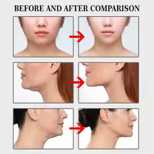 Cinta Facial de Elevación Invisible – Pack x100