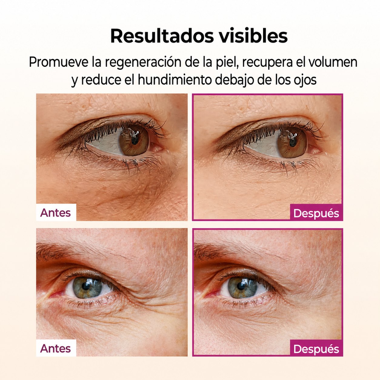 Bálsamo Hidratante y Reafirmante para Contorno de Ojos, Rostro y Cuello – Dr. Melaxin